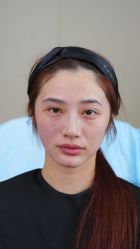 -佛山曙光金子医学美容医院