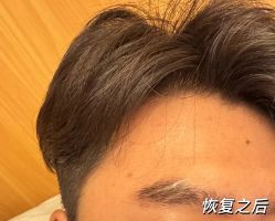 -西施无菌半永久纹绣眉眼影唇轻增发纹发际线