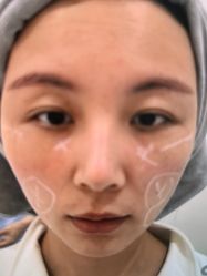 -长沙雅美医疗美容医院