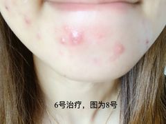 -上海市皮肤病医院(武夷路院区)