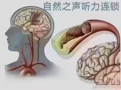 -自然之声助听器(平凉店)
