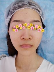 体验前-深圳美莱医疗美容医院