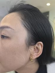 -长沙雅美医疗美容医院
