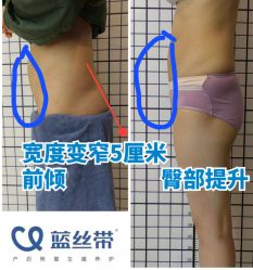 -蓝丝带产后恢复中心(都江堰店)