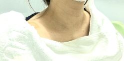 体验前-欧扬医疗美容