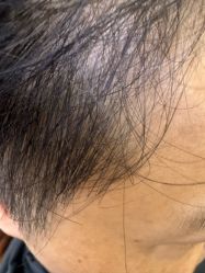 -诗碧曼养发