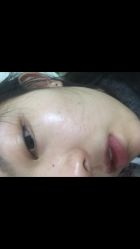 -苗方清颜专业祛痘连锁机构