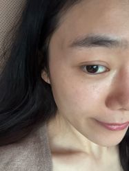 -小忠丽格医美