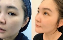 -SKINIST丽铂医疗美容