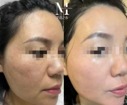 -意奈儿·美高之春皮肤管理中心