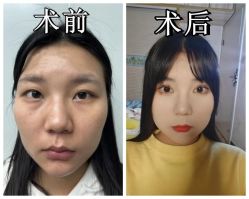 -素美医疗美容·西南眼鼻整形·修复基地