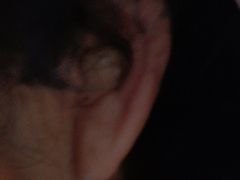 -自然之声助听器·呼吸机(公园路店)