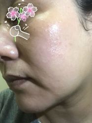 体验后-上海玫瑰医疗美容医院