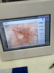 -成都苗方清颜专业祛痘