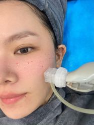 -More摩尔医美の注射线雕光电中心