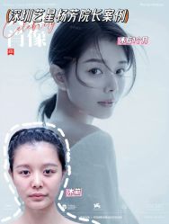 -深圳艺星医疗美容医院