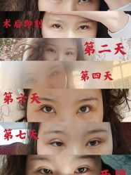 -Yestar宁波艺星整形医院