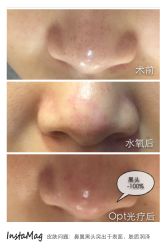 脸部抗衰-光SPA科技美肤