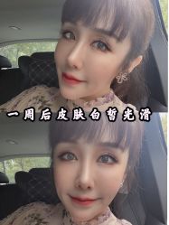 -众山臻美医疗美容医院