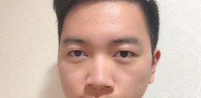 -天津健丽·去眼袋医疗美容机构