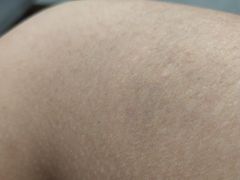 -郑远元专业修脚房(昌里东路店)