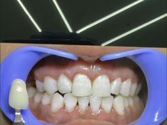 -极光口腔·矫正种植修复(锦江院区)