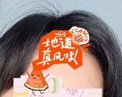 -大麦微针植发全国连锁