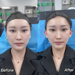 体验前-美莱医学美容医院