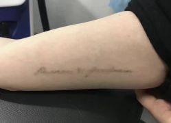 -天道专业洗纹身