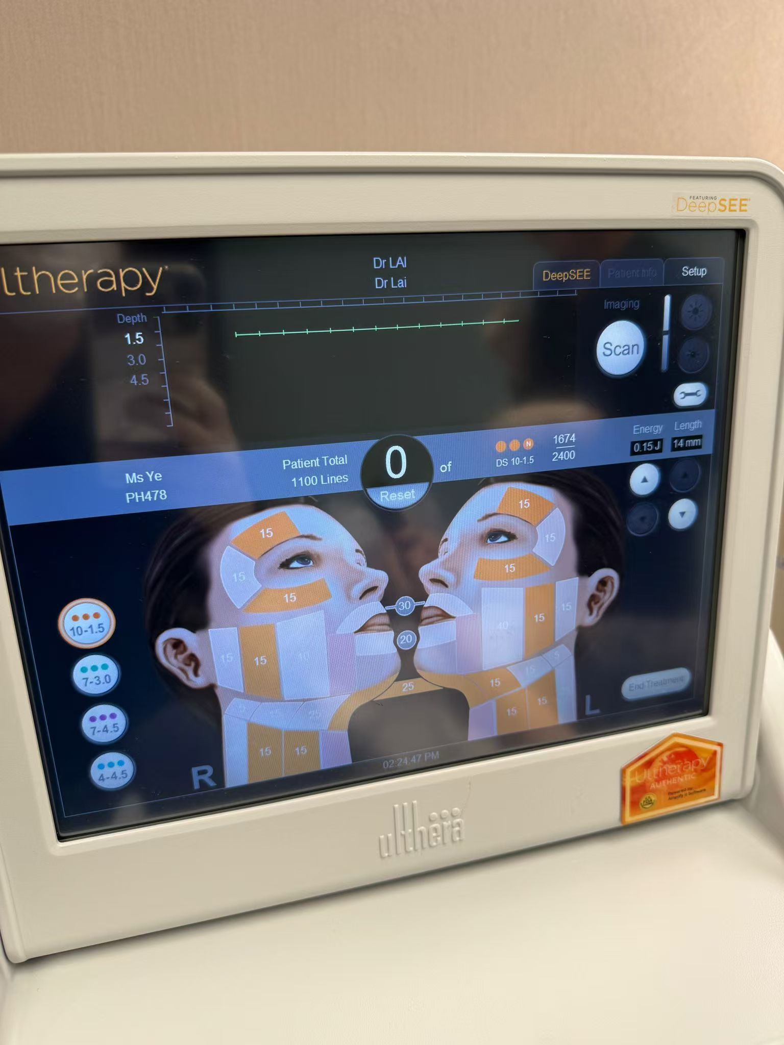 美版超声刀没多久,真的ren不住分享给大家😭