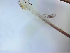 -昆明爱尔眼科医院