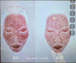点击看大图 -半岛故事·法儿曼抗衰·indiba中心