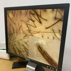 -章光101防脱养发荟
