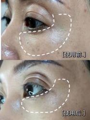 -凡碧诗毛孔收细