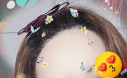 -大麦微针植发全国连锁