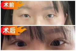 -素美医疗美容·西南眼鼻整形·修复基地