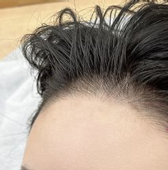 -西施无菌半永久纹绣眉眼影唇轻增发纹发际线