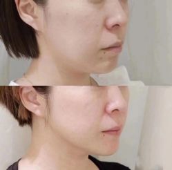 点击看大图 -上海漾颜医疗美容