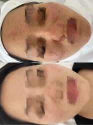 -康美贞·痘肌养护管理中心