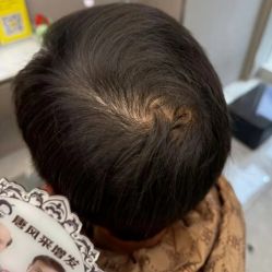 -唐风采假发补发定制