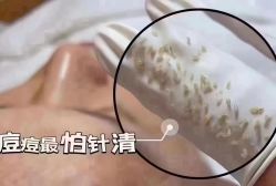 -瑶芳清颜草本祛痘