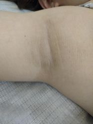 点击看大图 -日本直营PURE专业脱毛中心