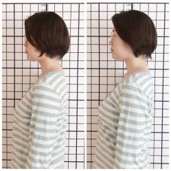 -FACE·日本小颜矫正美容整骨サロン