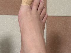 -世龙世家灰指甲鸡眼脚气甲沟炎跖疣护理(通州店)