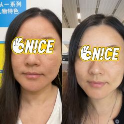 体验前-恒妍医美·韩国定制抗衰中心