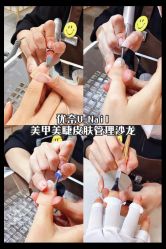 -U-Nail