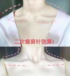 -上海漾颜医疗美容