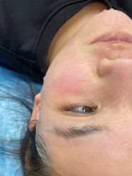 -长沙雅美医疗美容医院