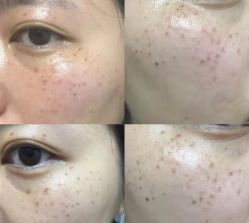 点击看大图 -安徽合肥韩美整形外科医院