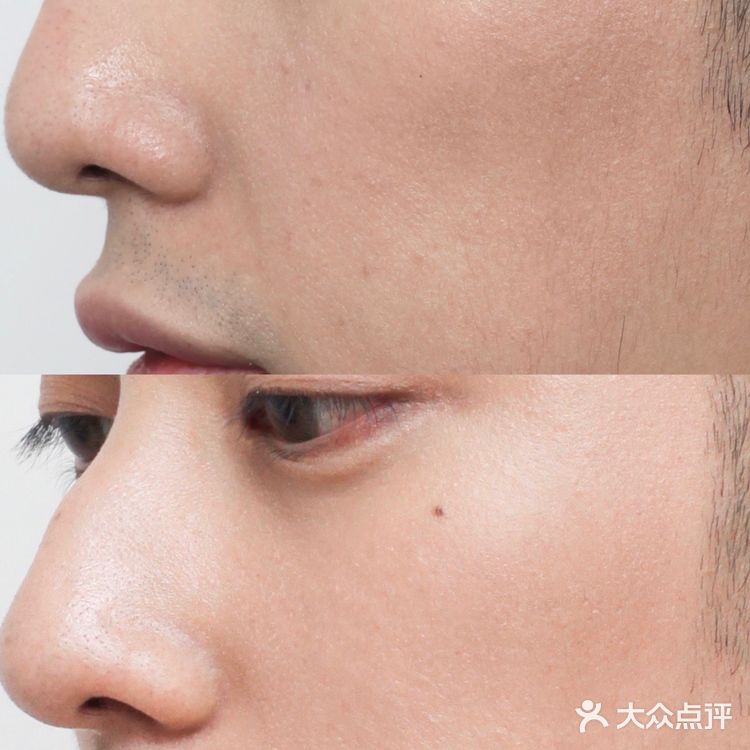 熬夜肌肤必备｜雅诗兰黛小棕瓶第7代🏾